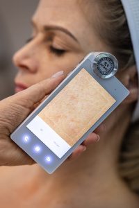 Debreceni bőrdiagnosztika az emesekozmetikánál!
